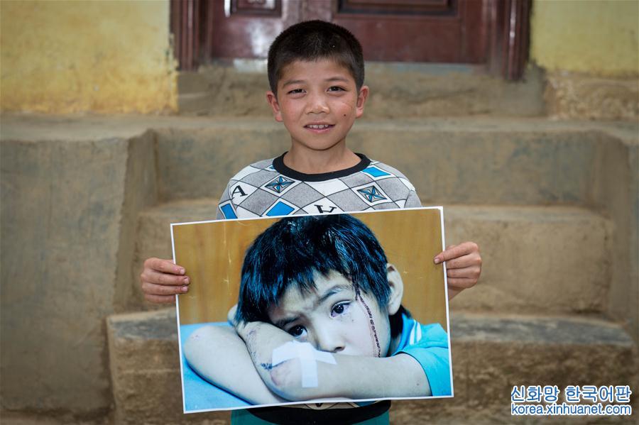 （社会）（1）鲁甸地震三周年：寻访灾区“大眼睛”男孩