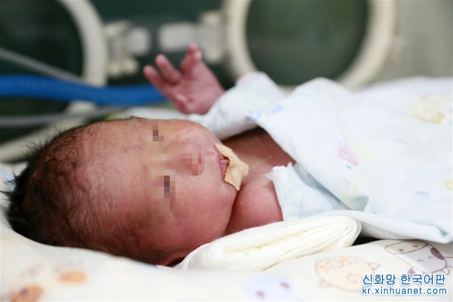 （图文互动）（3）中国首个移植子宫内孕育宝宝在西京医院出生