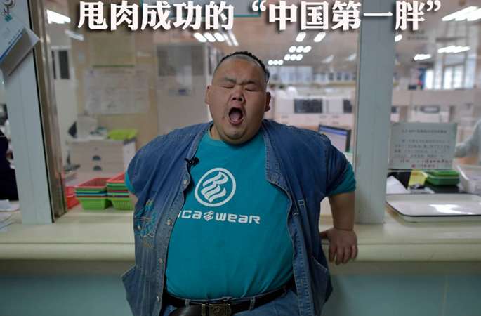 다이어트에 성공한 ‘중국 최고 뚱보’