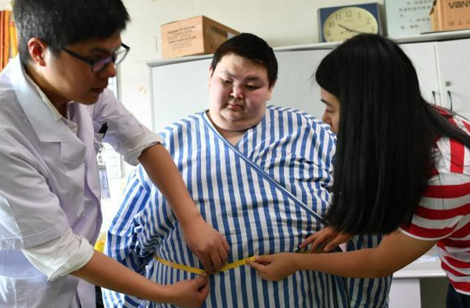 놀라운 변신! 중국 “비만왕” 청두에서 5개월 다이어트, 140근 감량