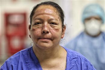 멕시코: 간호사 얼굴…마스크에 눌린 자국 가득
